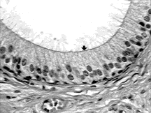 Cross Section B