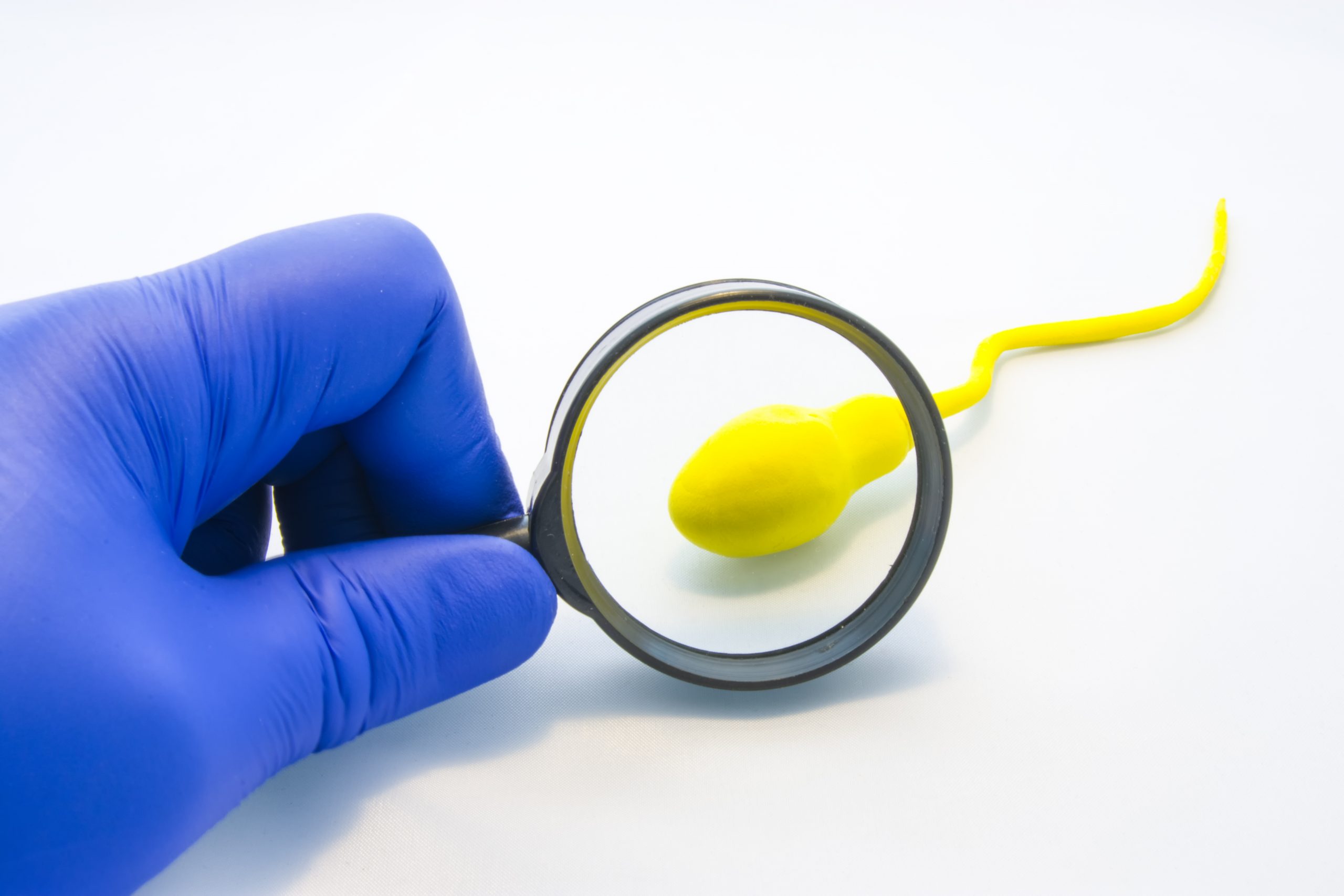 See Real Vasectomy Scars: Are Yours Normal? - c32cha6