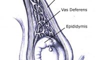 Spermatic cord diagram